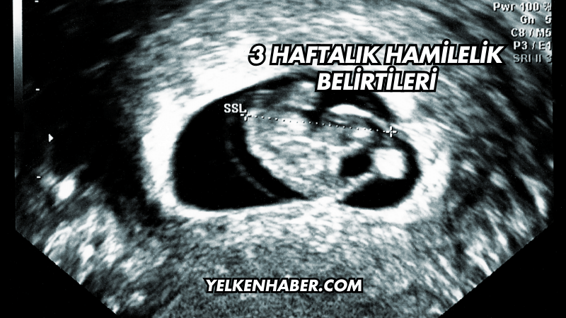 3 Haftalık Hamilelik Belirtileri