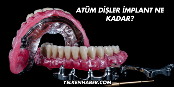 Tüm Dişler İmplant Ne Kadar?